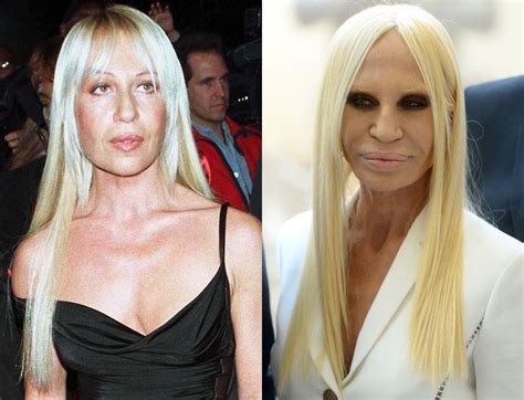 trasformazione donatella versace|donatella versace before and after surgery.